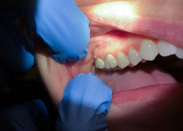 Best Pediatric Emergency Dentist in Contoocook, NH