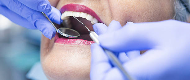 Best Emergency Root Canal Treatment in Contoocook, NH
